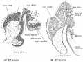 Fig. 105. Showing stages of development of the Pineal Body in the roof of the Fore-Brain
