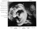 Fig. 88. Human embryo with 28 primitive segments.