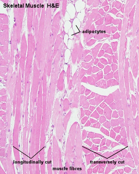 File:Skeletal muscle histology 014.jpg