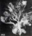 Fig. 262. Isolated villous tree. No. 2336. X6.75.