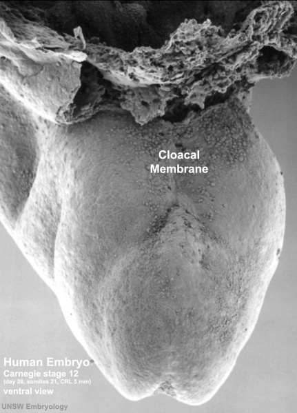File:Stage12 sem9 cloacal membrane.jpg