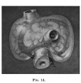Fig 14 human embryo 5 mm
