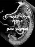 Stage16 MRI S01 icon.jpg