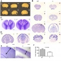 Colony Stimulation Factor-1 Receptor and Embryonic Olfactory Development- Absence of CSF-1R results in perturbed brain architecture.