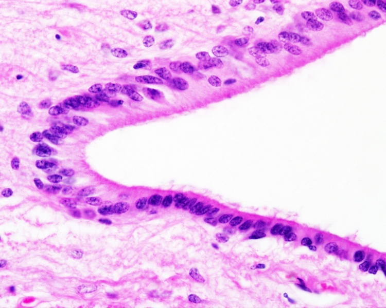 File:Spinal cord histology 09.jpg