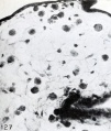 Fig. 127. Section of a villus from No. 510, showing scattered Hofbauer cells. X300.