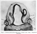 Fig. 8. Vertical section through head of pig 8 mm long
