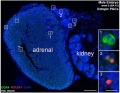 male adrenal (and adjacent kidney) week 8 (GA week 10)