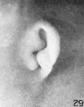 Fig. 29. Embryo No. 2163, 36 mm.