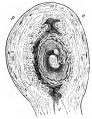 Fig. 4. Semi-diagrammatic outline of an antero-posterior section of the gravid uterus and ovum of five weeks