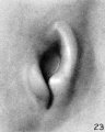 Fig. 23. Embryo No.547, 18 mm. long. X 22.