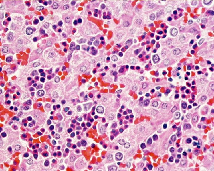File:Histology-fetal liver HEx40.jpg