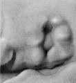 Fig. 16. Embryo No. 562 13 mm