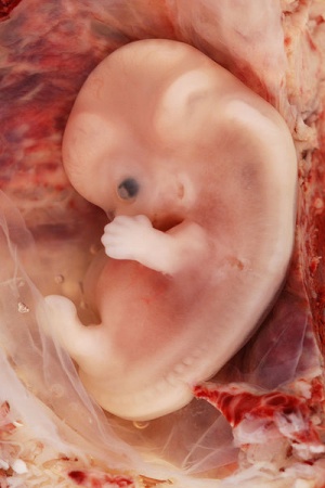 9 Week Human Embryo.jpg