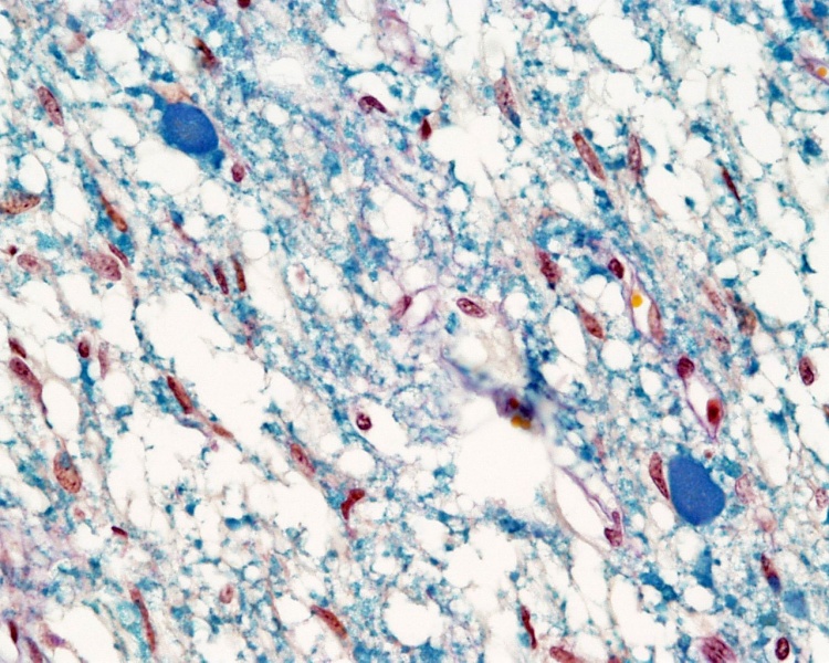 File:Pituitary histology 004.jpg