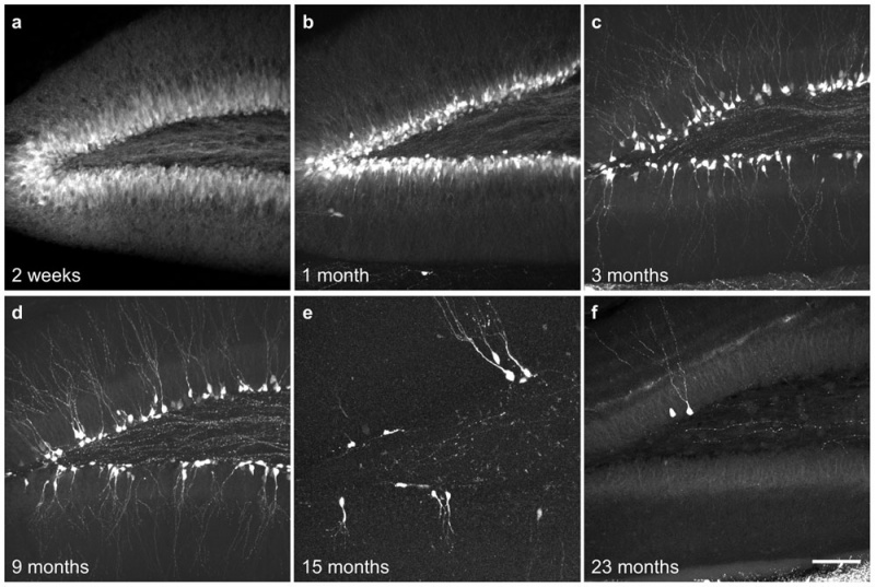 Mouse- hippocampus dentate granule cells.jpg