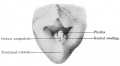 Fig. 640. The indifferent external genitalia of an embryo of 28 mm GL. The cloacal tubercle is divided into the phallus and the genital tubercles or swellings. The ostium urogenitale and anus are still close together.