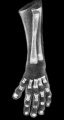 Fig 5 Embryo No. 300 Hand