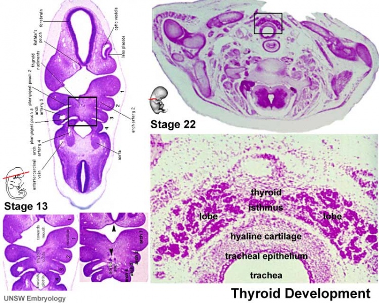 File:Stage13 and 22 thyroid development a.jpg