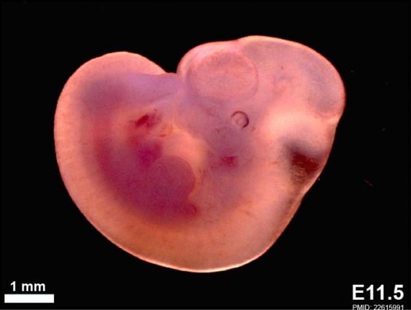 Mouse embryo E11.5.jpg
