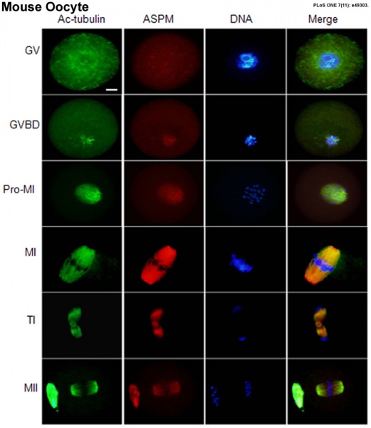 File:Mouse oocyte microtubule-associated protein 01.jpg