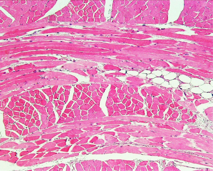 File:Skeletal muscle histology 001.jpg