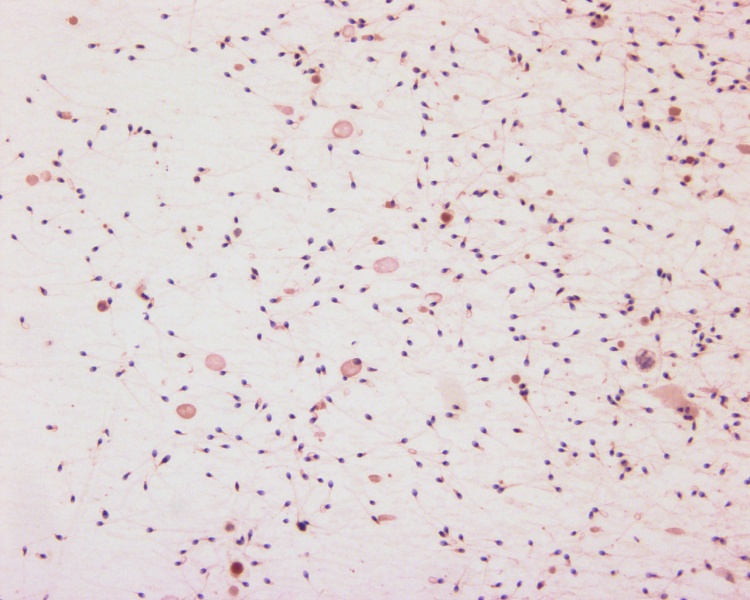 File:Spermatozoa histology 001.jpg