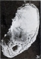 Fig. 31. Part of the same conceptus in section, showing the cavities of both chorionic vesicles. Xl.5.