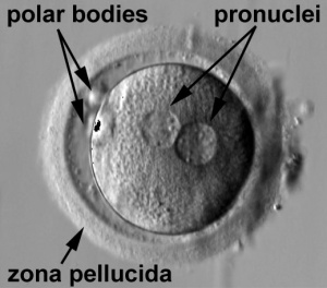 Early Zygote two pronuclei