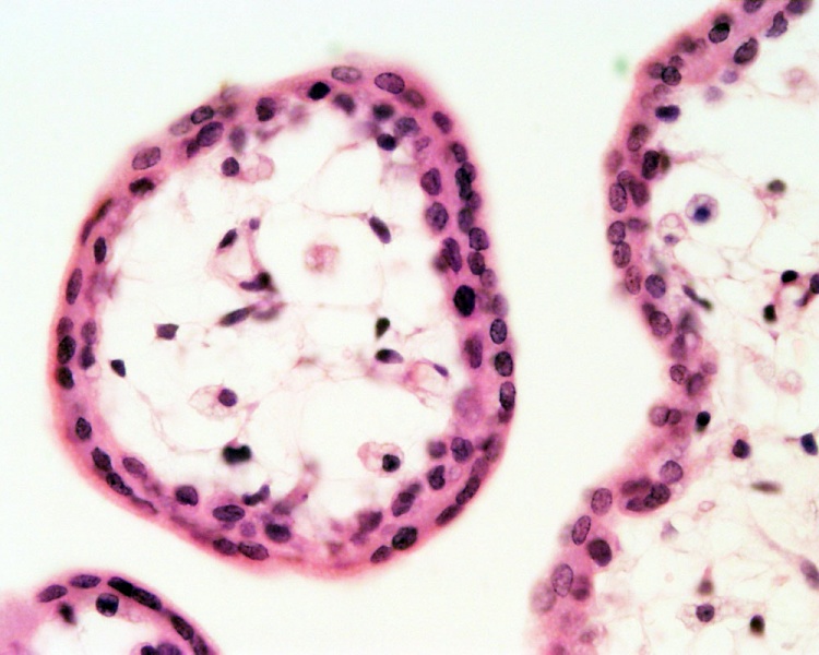 File:Placenta- first trimester histology x40.jpg