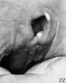 Fig. 22. Embryo No. 576 17 mm. long. X 17.