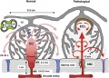 Placenta spiral artery conversion
