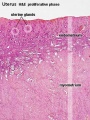 Uterine body endometrium and myometrium during the proliferative phase of the menstrual cycle overview