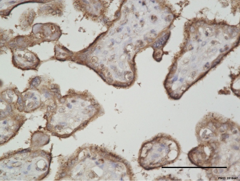 File:Human placenta vasohibin 2 expression.jpg