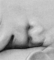 Fig. 15. Embryo No. 1461 10 mm