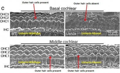Basal Cochlear Outer Hair Cells.jpg