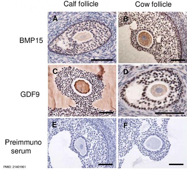 File:Bovine ovarian follicle BMP15 and GDF9 expression.jpg