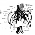 Fig. 10 Horseshoe kidney
