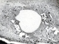 Fig. 122. Extremely marked epithelial proliferation on a small hydatiform villus with glassy stroma. No. 415. X95.