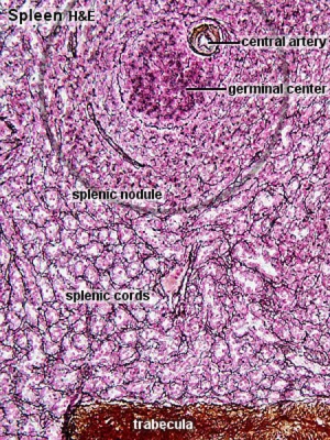Spleen histology 05.jpg