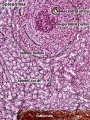 Spleen reticular fibres (overview)