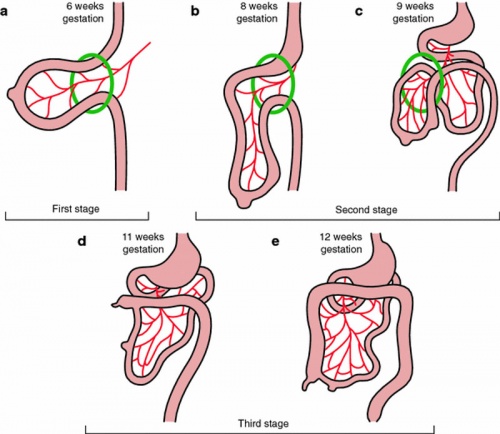 Normal intestinal rotation cartoon.jpg