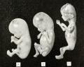 1920 Human Embryo Growth