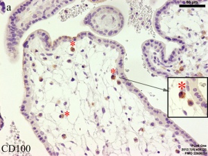 Hofbauer Cells