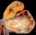 Human corpus luteum (large image)