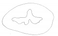 Fig 1. Human Fetus 5 cm