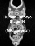 Stage16 MRI C01 icon.jpg