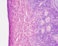 Ovary histology (monkey) showing the tunica albuginea and primordial follicles x20