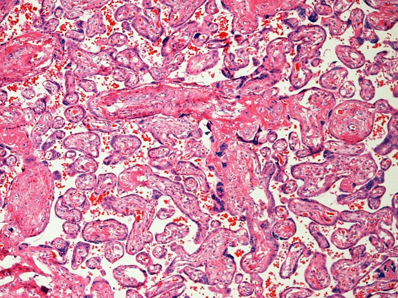 File:Placenta histology 004.jpg