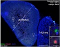 female adrenal (and adjacent kidney) week 11 (GA week 13)